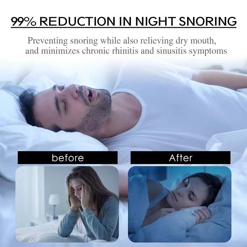 Dream® | Nasal Dilation & Mouth Tape 30 Strip Bundle